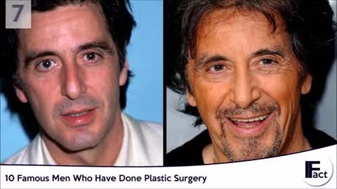 10 Famous Men Who Have Done Plastic Surgery