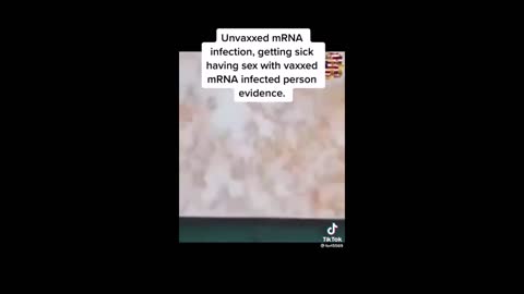 Unvaxxed has Similar Blood as Vaccinated Person, thru Sex ?