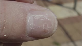 Fingernail Goes for a Drive