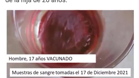 COMPARACIÓN DE SANGRE ENTRE VACUNADOS Y NO VACUNADOS