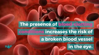 What Causes A Broken Blood Vessel In The Eye?