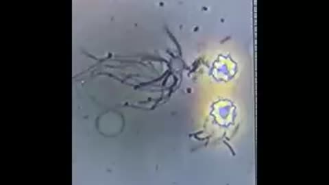 Blood Giving Birth to Spike Protein - An Outfection Caused by Radiation, Graphene & Parasites