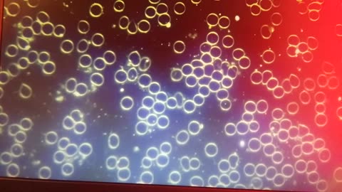 Kurzweils Singularity-Footage Of Microrobots In C19 Unvaccinated Blood