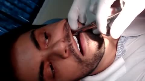 DENTISTA TESTA O QUE APRENDEU NA UNIVERSIDADE E ARRANCA O PRÓPRIO SISO