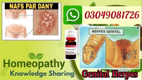 Genital herpes | Causes, Symptoms, homeopathic medicine for genital herpes | Dr.Abdul Manan
