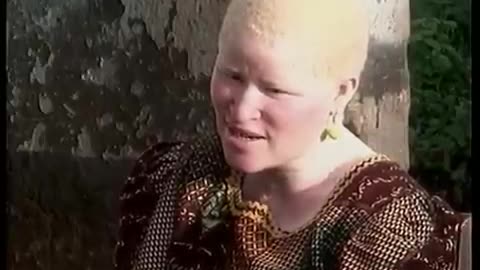 Deadly Hunt - Albinos in Tanzania
