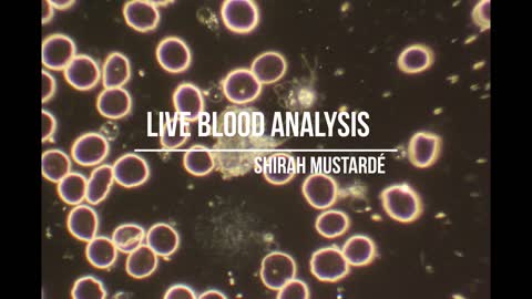 Live Blood Assessment in Long Covid and Vaccine Injury
