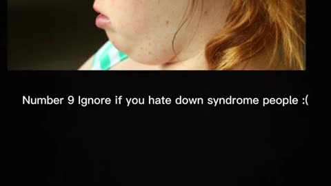 Why i hate down syndrome children