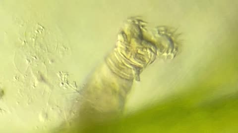 Microscopic Rotifer Spins Cilia