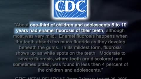 Infant Fluoride Warning from CDC & ADA