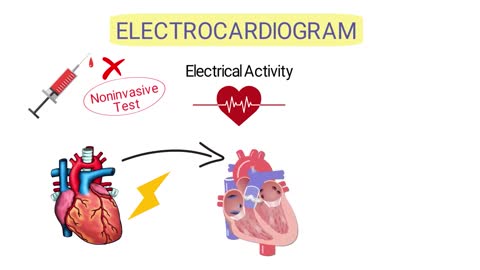 What is an Electrocardiogram? (EKG/ECG) *SIMPLE Explanation*