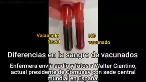 SANGRE VACUNADO VS NO VACUNADO