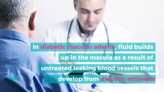 Treating And Managing Diabetic Macular Edema