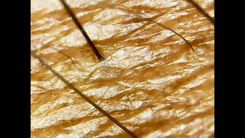 microscopic view of human skin, hair and hair root