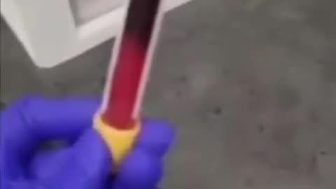 Vaccinated patient's blood clots in 3 minutes instead of 30 minutes