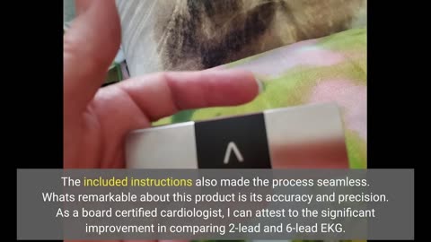 Buyer Reviews: KardiaMobile 6-Lead Personal EKG Monitor – Six Views of The Heart – Detects AFib...