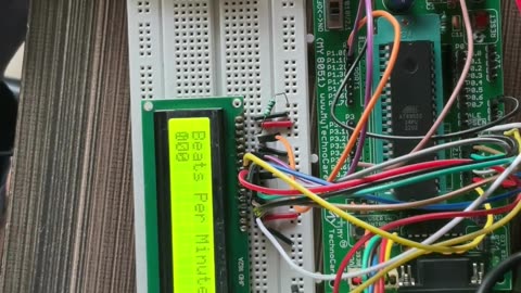 Heartbeat Monitoring System Using 8051microcontroller