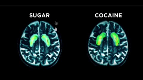 NEW Research: Sugar vs Cocaine #sugar #diabetes #addictionrecovery