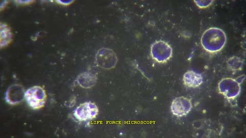 SOMATIDS OR MICROZYMAS in Live Blood under Darkfield microscopy and 4K