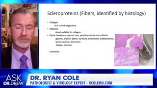 Foot-Long Blood Clots From mRNA, Says Pathologist Dr. Ryan Cole w_ Dr Kelly Victory