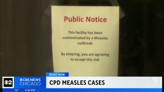 Chicago Police Department suffers an Measles Outbreak - Thank You Open Borders