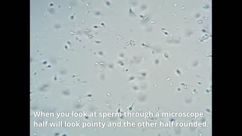 I Took My Semen And Put It Under My Microscope - 1000x Magnification