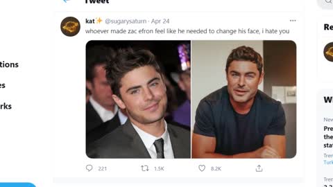 Zac Efron Plastic Surgery Rumors' || Trending Now