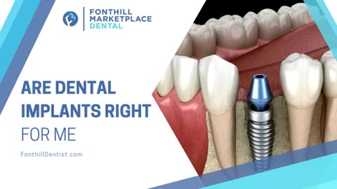 Is Dental Implant the Suitable Choice for Me?