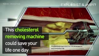 Cholesterol Machine