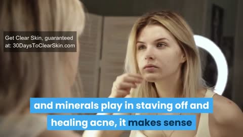 Acne natural Cure with Home made remedies and ideas