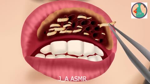 Snake In Mouth Animation - Satisfying Removal Of Snake & Maggots From Mouth