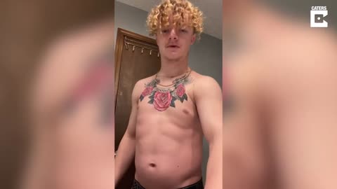 Man Born Without Collar Bones Can Clap His Shoulders