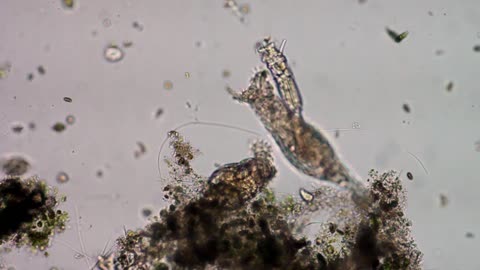 Bdelloid Rotifer