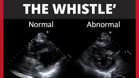 Aussie Doctor Blows the Whistle | Speaking Out Against the Vaccine