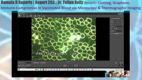 Report 293 | Dr. Felipe Reitz Reveals Clotting, Graphene, Immuno-Compromise in Vaccinated Blood