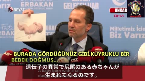 トルコのテレビ番組「ワクチン接種後の妊婦から生まれた奇形の赤ちゃん」