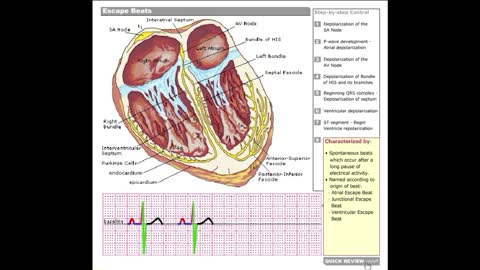 Dr Stanley's ECGcourse.com | Escape Beats Tutorial