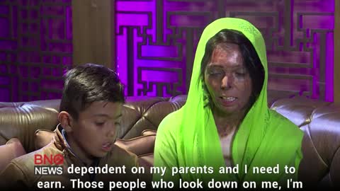 Acid Attack Survivors Take to Catwalk in New Delhi Fashion Show