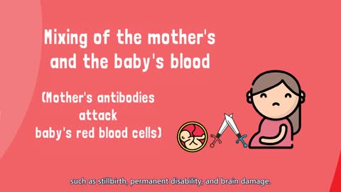 [Quick Guide] How does blood type (Rh) incompatibility affect pregnancies? Part 2