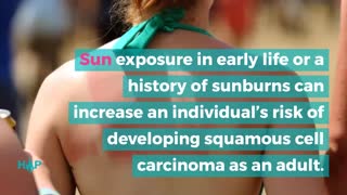 Causes & Risk Factors Of Squamous Cell Carcinoma