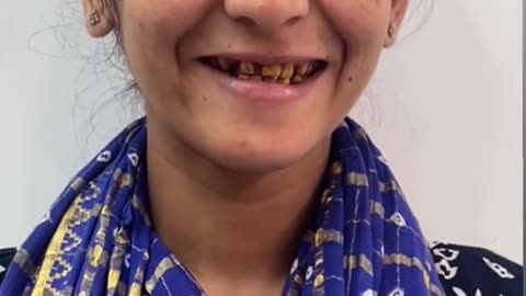 Full Mouth Reconstruction Treatment in Navi Mumbai