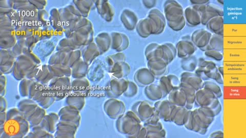 Nouvelles observations des Vaccins COVID au microscope