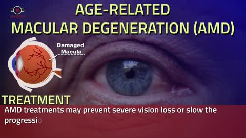 Eye problems and treatment | Top ENT Specialist in Delhi