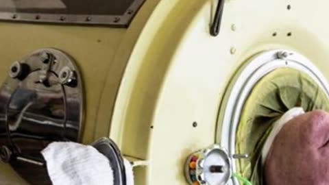 Breathing Against Time: The Last Iron Lung User