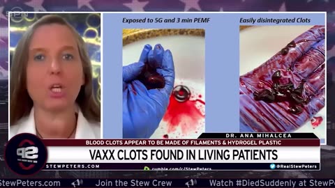 Clot From Vaxx Found In LIVING Patient, Congressman Andy Biggs On McCarthy's FAILURE