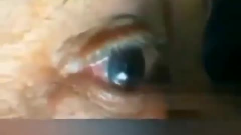 REPTILLIAN VRIL TAKEN OUT OF EYE - DIFFICULT TO WATCH