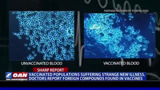 'Vaccinated' populations suffering strange new illness doctors report
