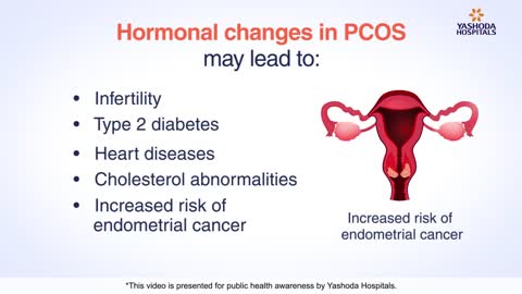 PCOS / PCOD - Polycystic Ovarian Syndrome Symptoms, Causes, And its Treatment