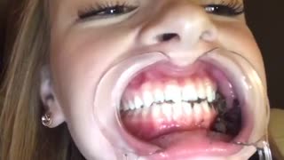 Girl eating chocolate with dental mouth opemner