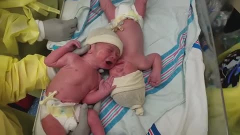 Newborn Twins Become Upset When Separated